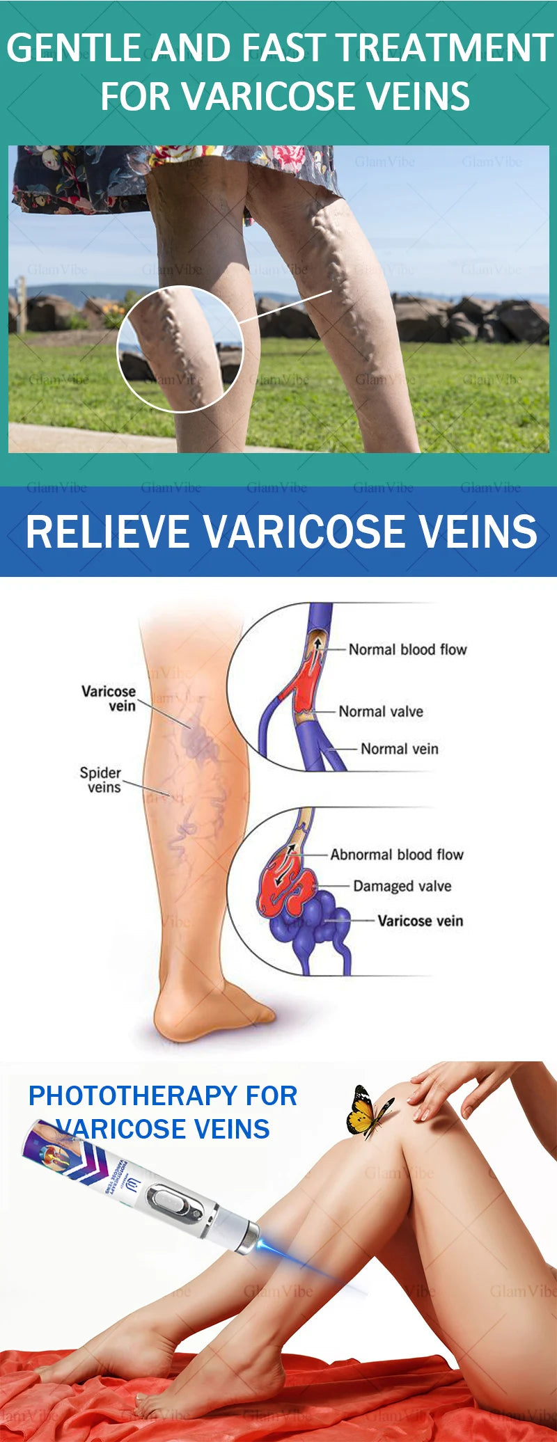 Laser venous pointers address varicose veins, and leg care tools are hot sellers.