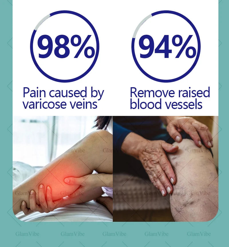 Laser venous pointers address varicose veins, and leg care tools are hot sellers.