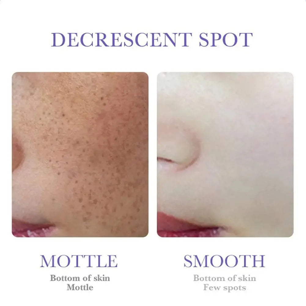 SADOER Freckle Removing Cream Nicotinamide Face Cream for Faical Moisturizing Nourishing Hydrating Firming Spot Facial Creams