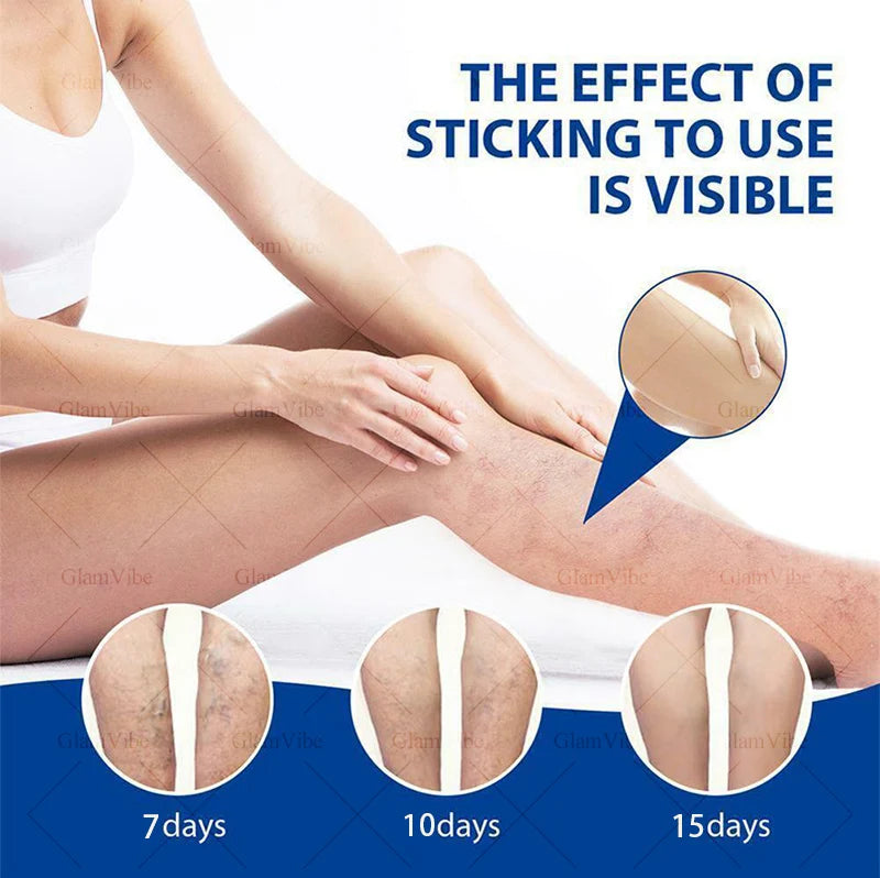 Laser venous pointers address varicose veins, and leg care tools are hot sellers.