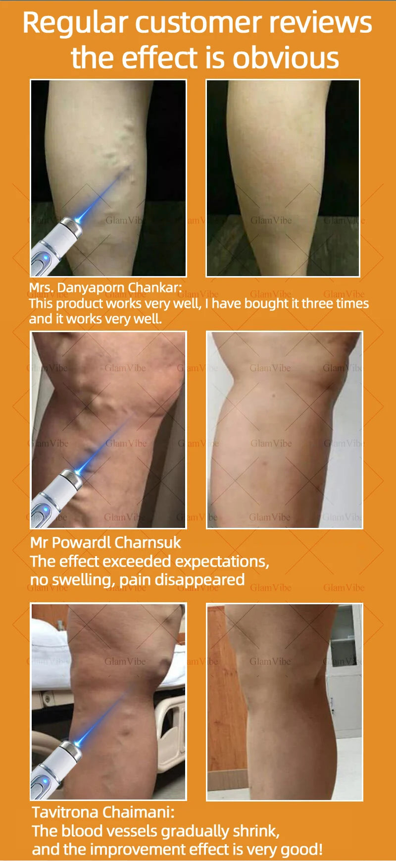 Laser venous pointers address varicose veins, and leg care tools are hot sellers.